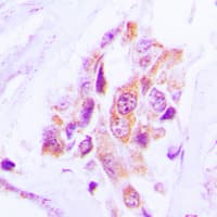 Polyclonal Rabbit anti-Human MARK1+2+3+4 Antibody (Internal, IHC, IF, WB)
