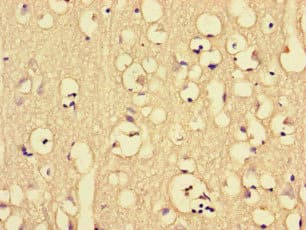 CKAP2L Antibody