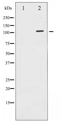 SIRT1 / Sirtuin 1 Antibody (phospho-Ser47)