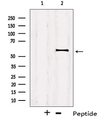 IRF2BP2 Antibody