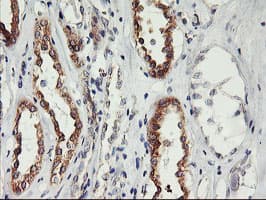 PHF21B Antibody (clone OTI3D1)