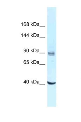 DDX23 / PRP28 Antibody (aa662-711)