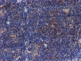 VCAM1 / CD106 Antibody (clone OTI4E8)