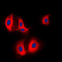 ALDOA / Aldolase A Antibody (N-Terminus)