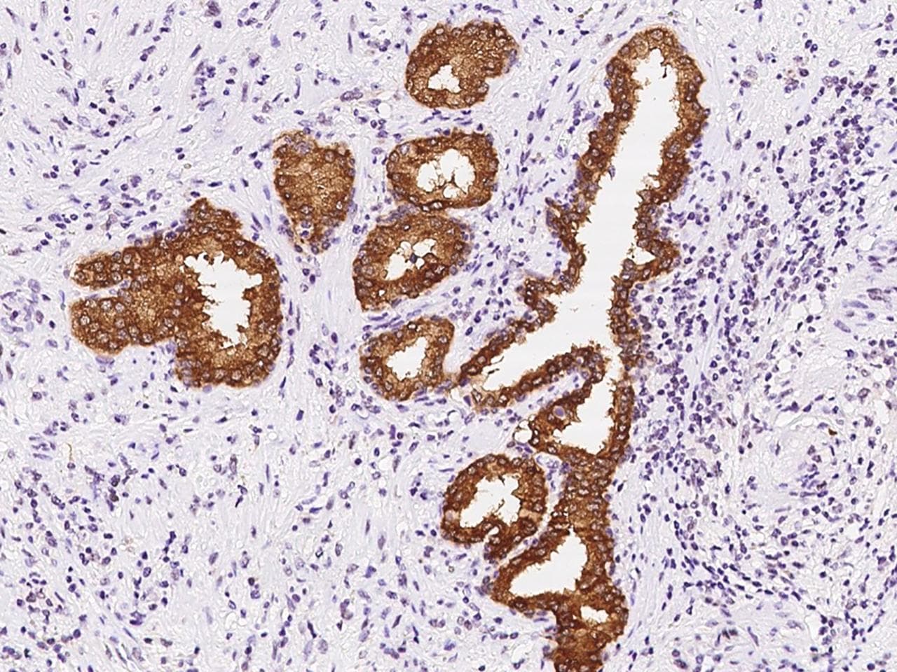 C1orf116 Antibody