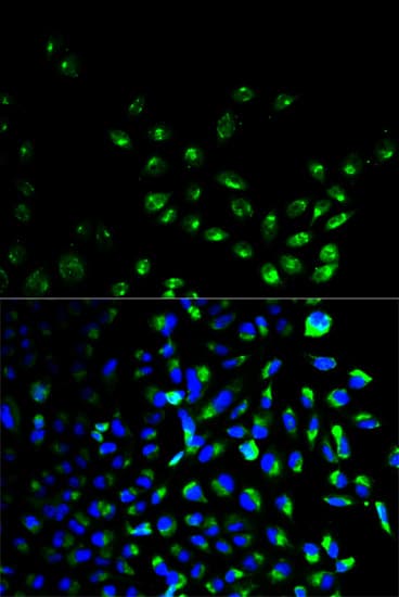 UCHL1 / PGP9.5 Antibody