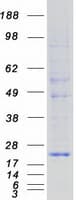 Human KDELR1 / HDEL Protein (Recombinant Myc-DDK (Flag))
