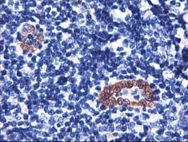 Monoclonal Mouse anti-Human LMCD1 Antibody (clone OTI1H5, IHC, IF, WB)