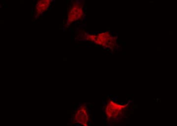 RELA / NFKB p65 Antibody (phospho-Ser536)