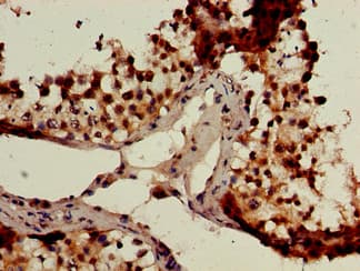 GCM2 Antibody