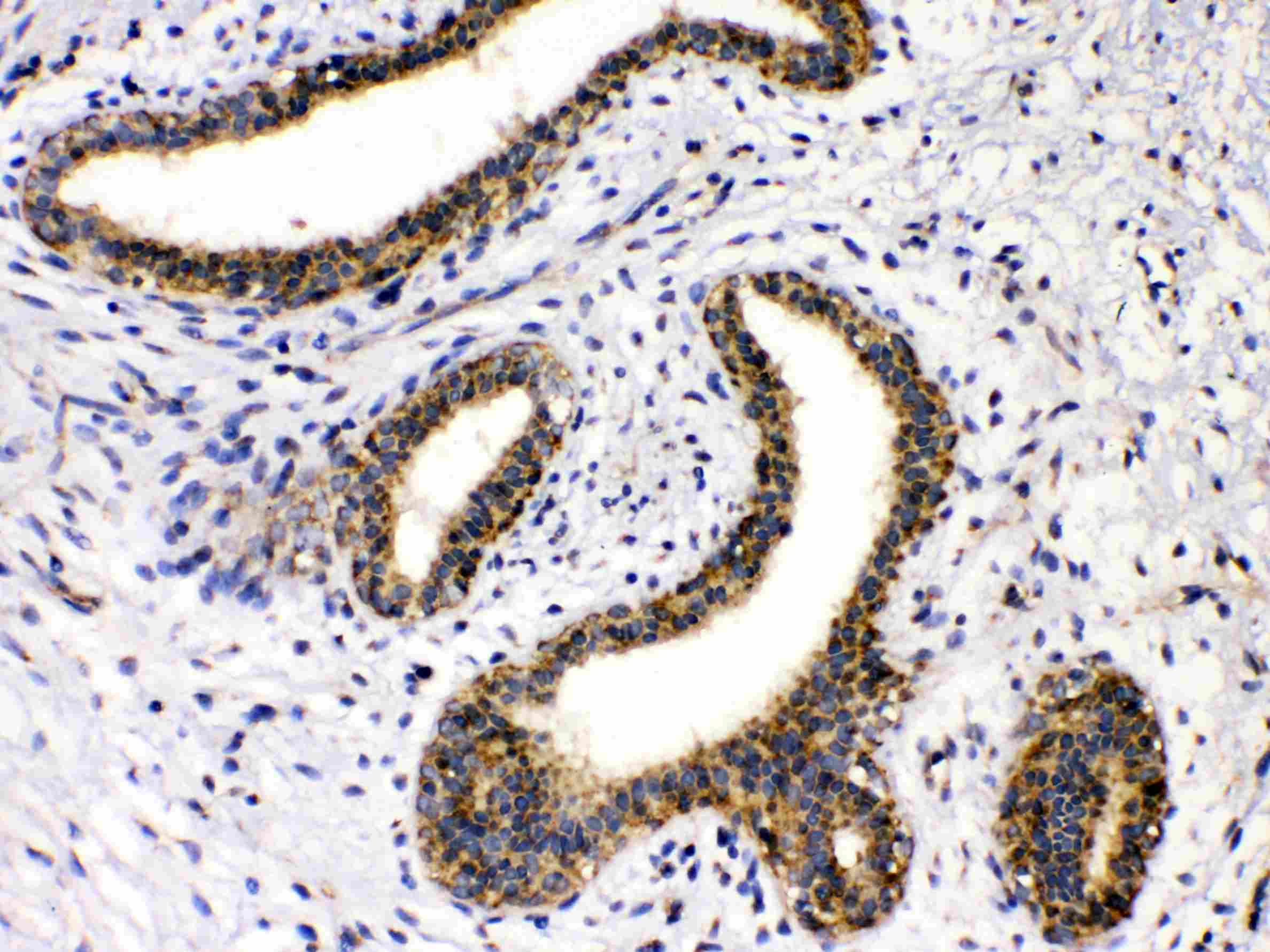 Polyclonal Rabbit anti-Human GAD65 Antibody (IHC, WB)