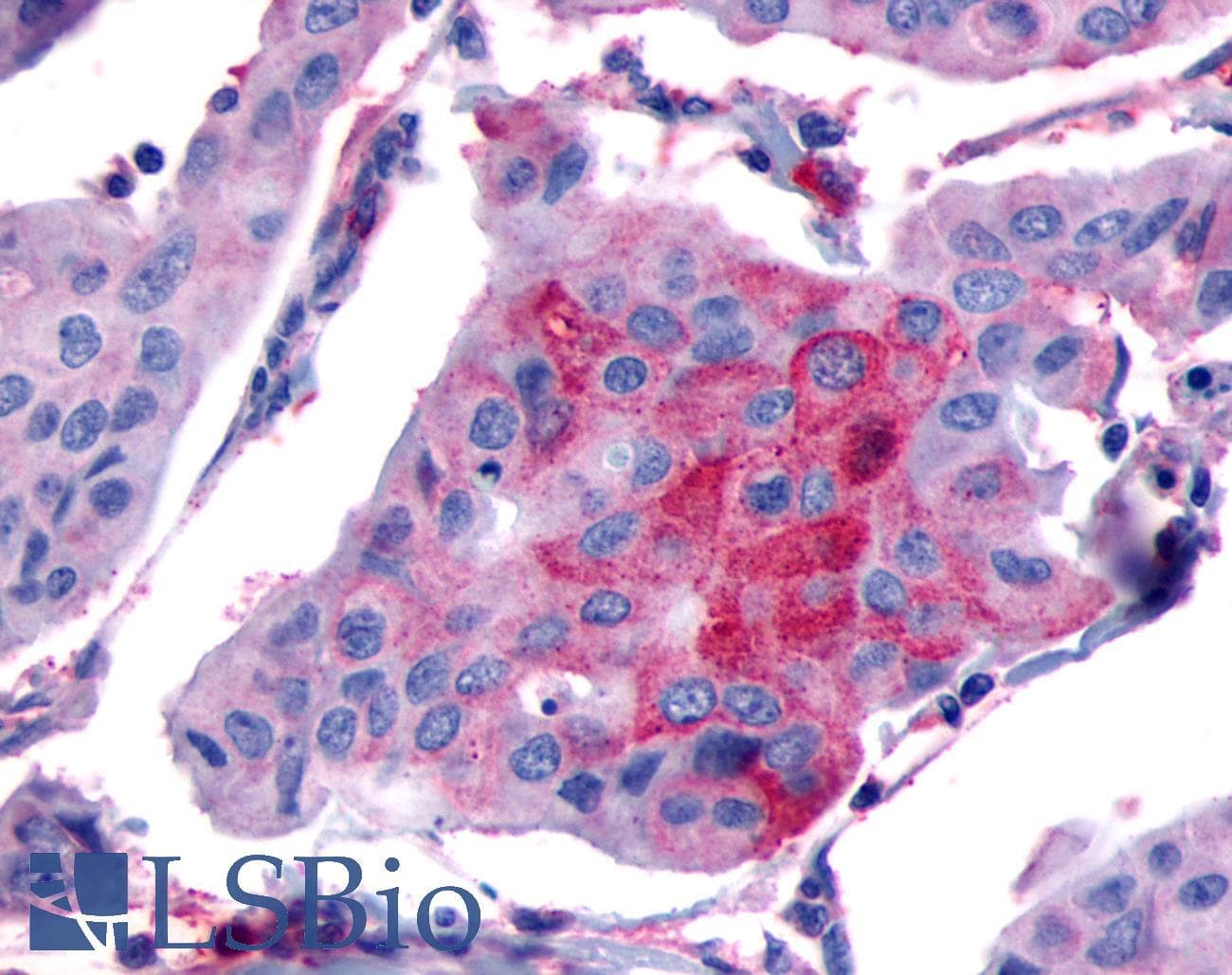 PathPlus™ FP / PTGFR Antibody (Extracellular Domain)