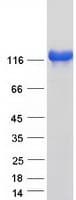 Human SRGAP2 Protein (Recombinant Myc-DDK (Flag))