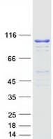 Human MARS Protein (Recombinant Myc-DDK (Flag))