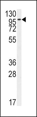 Polyclonal Rabbit anti-Human FGFR2 / FGF Receptor 2 Antibody (aa7-37, IF, WB)