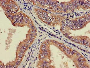RPS21 / Ribosomal Protein S21 Antibody