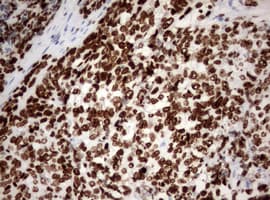Monoclonal Mouse anti-Human MKI67 / Ki67 Antibody (clone OTI9H1, aa1160-1493, IHC)