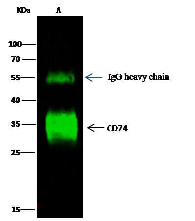 Polyclonal Rabbit anti-Human CD74 / CLIP Antibody (Preservative Free, IHC, WB)