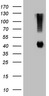 Monoclonal Mouse anti-Human ADH5 Antibody (clone OTI4D4, aa1-266, IHC, WB)