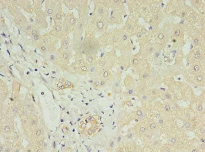 LYRM1 Antibody