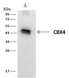 Polyclonal Rabbit anti-Human PAX2 Antibody (Preservative Free, IHC, IF, WB)
