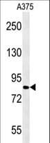 Polyclonal Rabbit anti-Human CPEB4 Antibody (aa109-137, IHC, WB)
