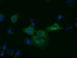 KLHL2 / MAV Antibody (clone OTI10C12)