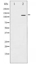 Polyclonal Rabbit anti-Human ITGB3 / Integrin Beta 3 / CD61 Antibody (IHC, WB)