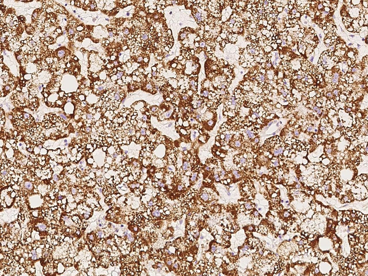 Polyclonal Rabbit anti-Human ACOT13 / THEM2 Antibody (Preservative Free, IHC, WB)