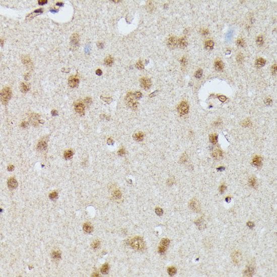 Polyclonal Rabbit anti-Human IGHMBP2 Antibody (IHC)