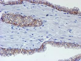 Monoclonal Mouse anti-Human ERBB2 / HER2 Antibody (clone OTI12G4, Carrier-free, aa676-1255, IHC, IF, WB)