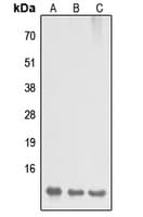 Polyclonal Rabbit anti-Human DYNLL2 Antibody (N-Terminus, IHC, WB)