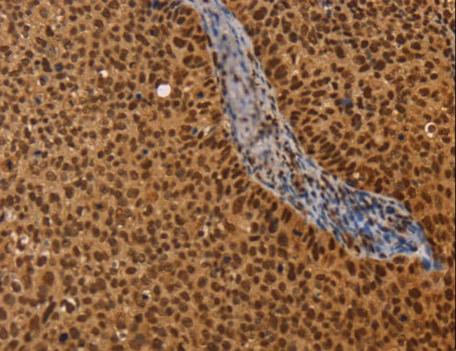 CEL / Carboxyl Ester Lipase Antibody