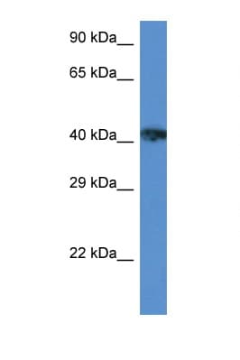 XRCC3 Antibody (aa122-171)
