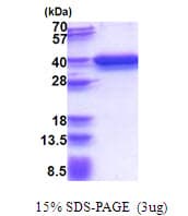 Human RPRD1A Protein (Recombinant His)