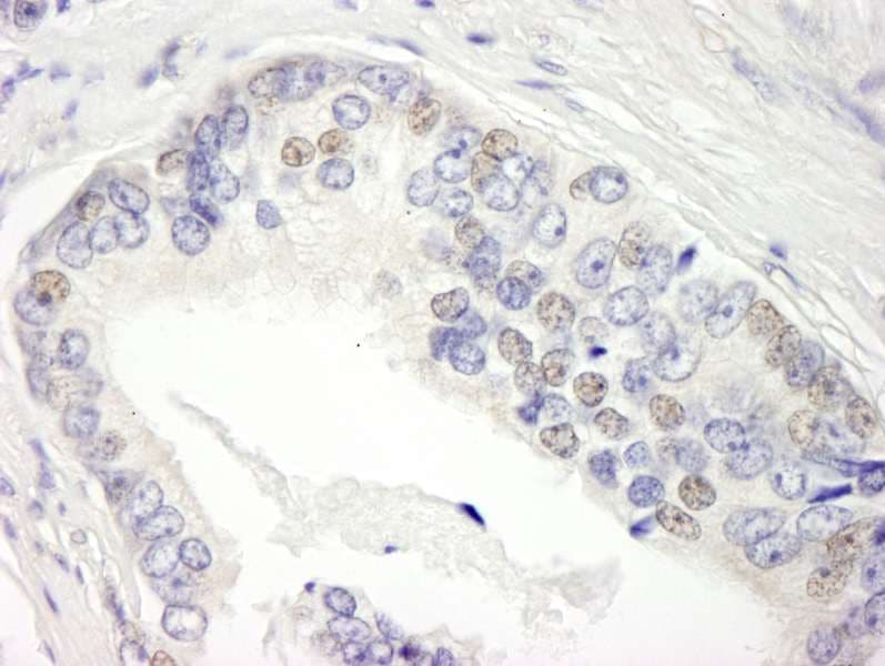Polyclonal Rabbit anti-Human BRD3 Antibody (aa676-726, IHC)