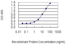 Monoclonal Mouse anti-Human ENTPD3 Antibody (clone 3E8)