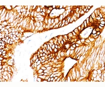 Monoclonal Mouse anti-Human Cytokeratin 8+18 Antibody (clone K8.8 + DC10, IHC, IF, WB)