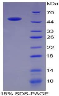 Pig ACE / CD143 Protein (Recombinant His-GST)