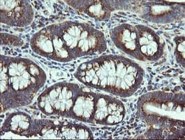 VTI1A Antibody (clone OTI1F4)