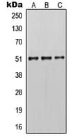 KRT14 / CK14 / Cytokeratin 14 Antibody (N-Terminus)