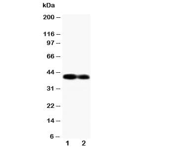 Polyclonal Rabbit anti-Human GJA5 / CX40 / Connexin 40 Antibody (aa341-358, IHC, WB)