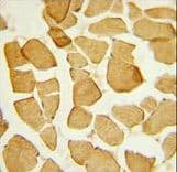 EYA4 Antibody (aa1-30)