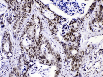 HNRNPF / hnRNP F Antibody
