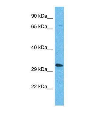 OR5AP2 Antibody (C-Terminus)
