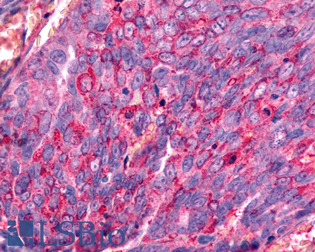 PathPlus™ Polyclonal Rabbit anti-Human GALR2 / Galanin Receptor 2 Antibody (Transmembrane Domain, IHC)