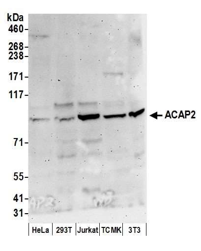 ACAP2 / Centaurin Beta 2 Antibody (aa728-778)