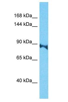 Polyclonal Rabbit anti-Human TARSL2 Antibody (aa653-702, WB)