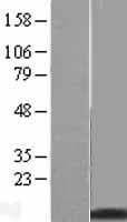 MT2A / Metallothionein 2A Protein (Over-Expression Lysate Myc-DDK (Flag))