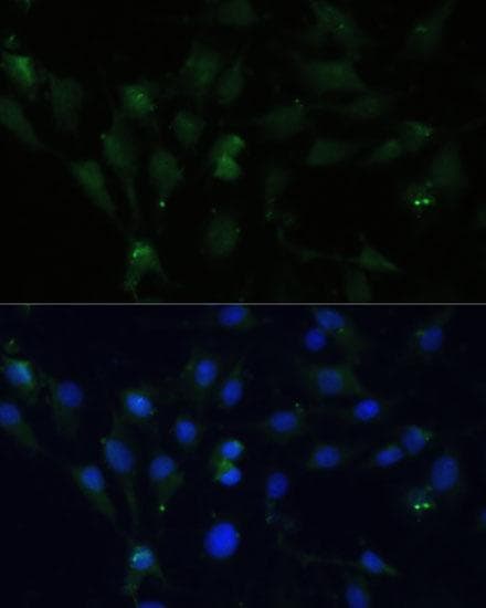 Polyclonal Rabbit anti-Human ZWINT Antibody (IF)